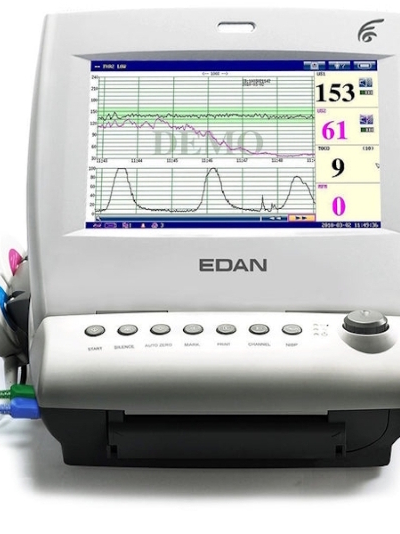 Spot Vital Signs Monitor